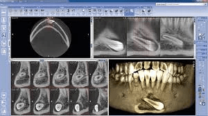 escaner 3d-Clinica Dental Ereaga